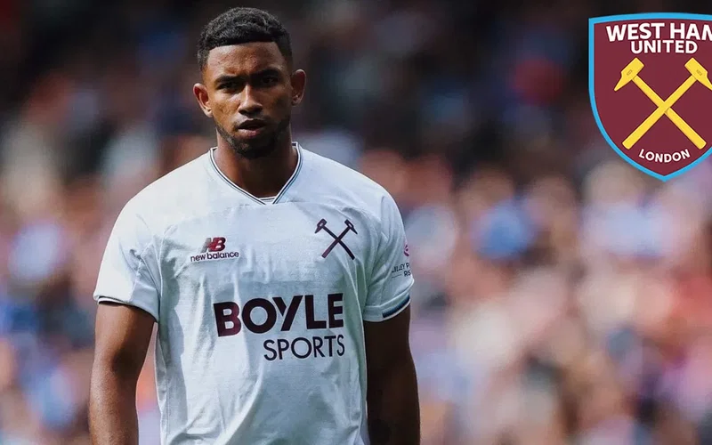 Image for Burnley v West Ham : Five ruled out through injury ahead of Sunday kick off